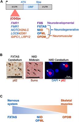 Trinucleotide CGG Repeat Diseases: An Expanding Field of Polyglycine Proteins?